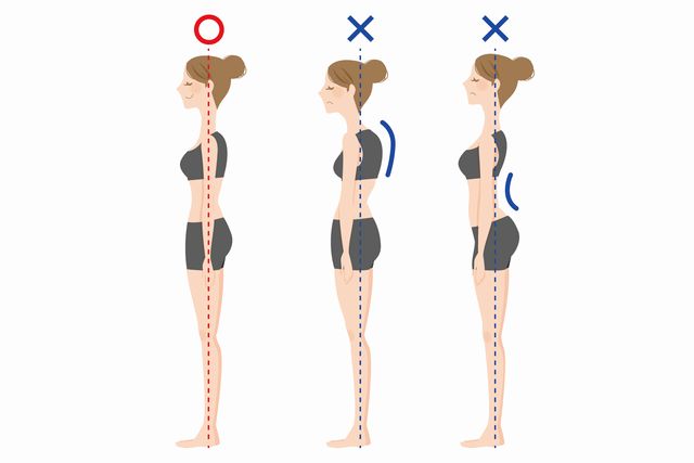 猫背矯正・姿勢改善